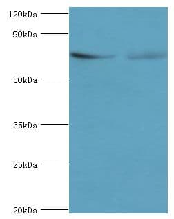 TCTN2 Antibody (aa420-670)
