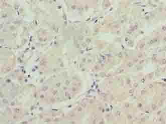 Polyclonal Rabbit anti-Human FAM168B Antibody (IHC)