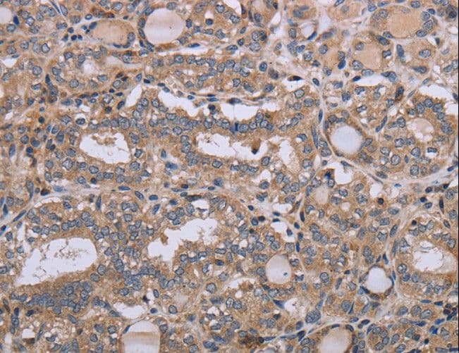 NAA25 Antibody