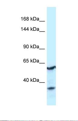 Polyclonal Rabbit anti-Human CNTROB Antibody (aa380-429, WB)