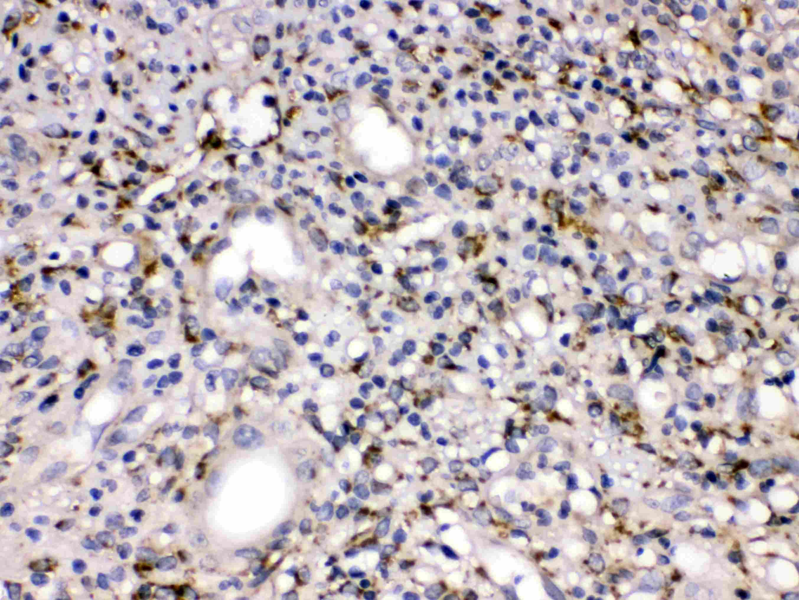 MMP11 Antibody