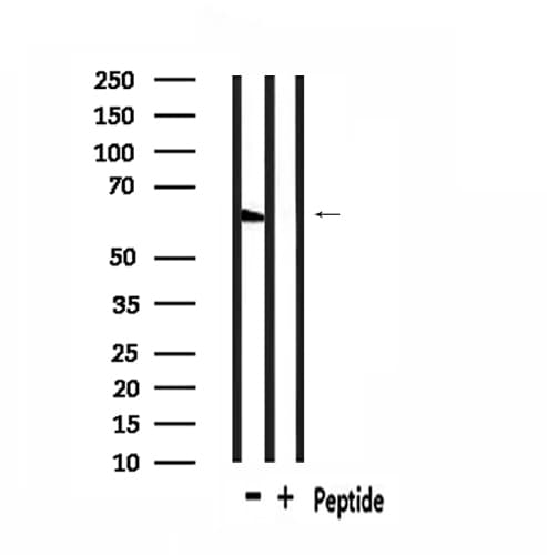 GPR148 Antibody