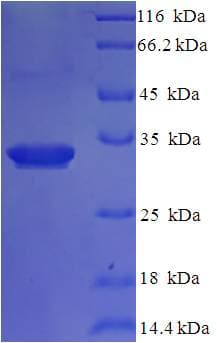 Human IL36RN / IL1F5 Protein (Recombinant His-SUMO)