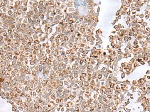 GLYAT Antibody