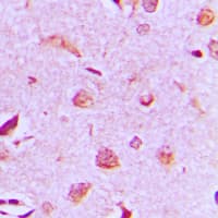 MAST3 Antibody (C-Terminus)