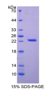 Human APRT Protein (Recombinant His-T7)