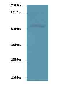Polyclonal Rabbit anti-Human PLXNA4 / Plexin A4 Antibody (WB)