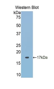 ACP1 / Acid Phosphatase Antibody (aa40-158)
