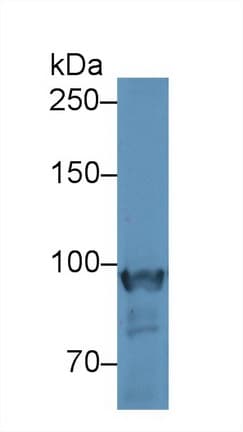 PYGM Antibody (aa11-187)