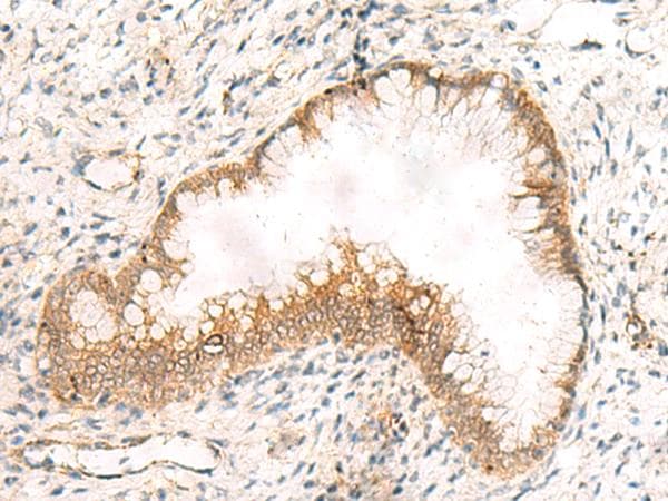ZNF397 Antibody