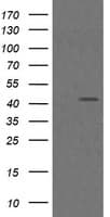 MAP2K1 / MKK1 / MEK1 Antibody (clone OTI4E1)
