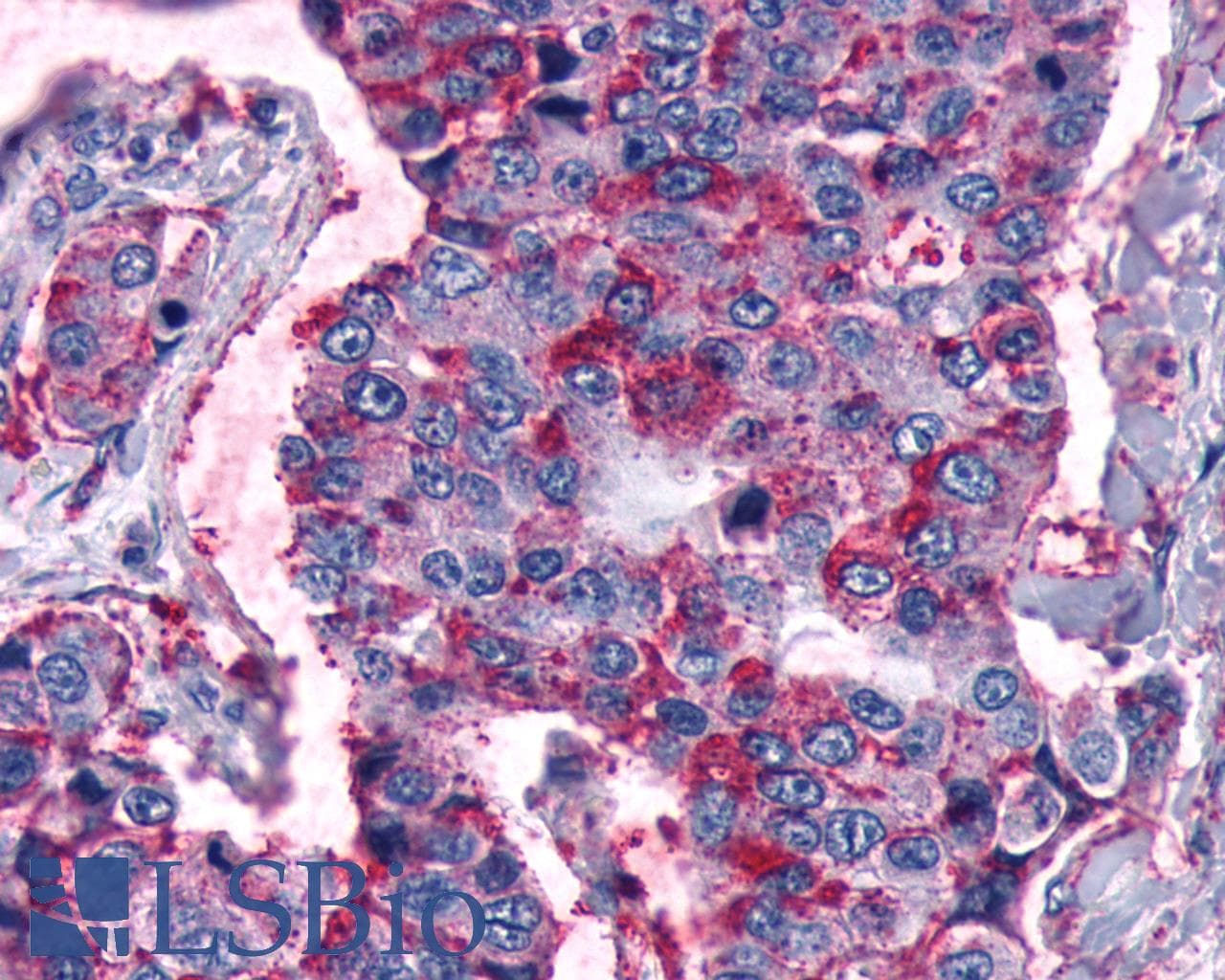 PathPlus™ FZD5 / Frizzled 5 Antibody (Cytoplasmic Domain)