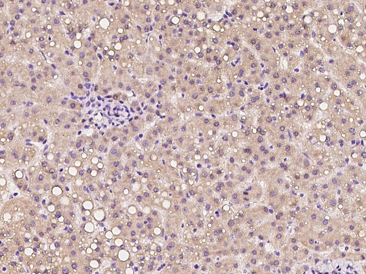 SLC31A2 Antibody