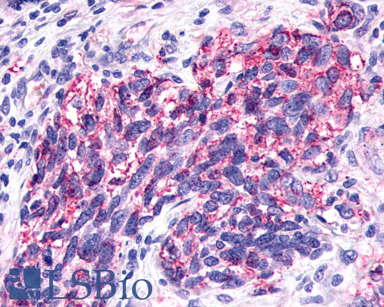 PathPlus™ SSTR1 Antibody (N-Terminus)