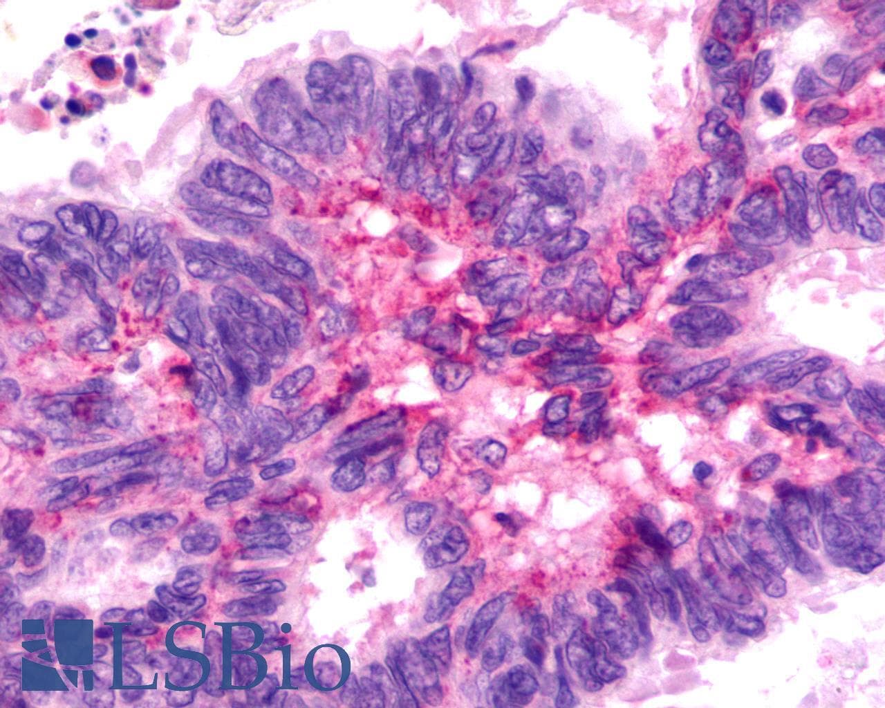 PathPlus™ F2RL3 / PAR4 Antibody (Cytoplasmic Domain)