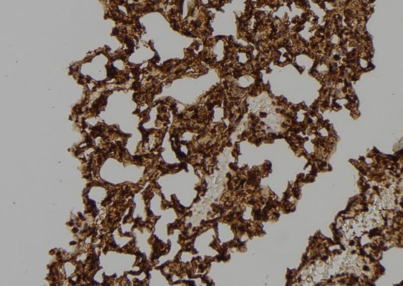 Polyclonal Rabbit anti-Human RAC2 Antibody (IHC, WB)