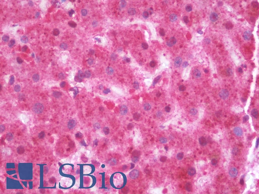 IHC-plus™ Polyclonal Rabbit anti-Human ARSB / Arylsulfatase B Antibody (IHC, IF, WB)