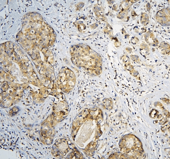 CPAMD8 / KIAA1283 Antibody