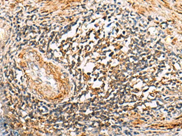IPAF / NLRC4 Antibody