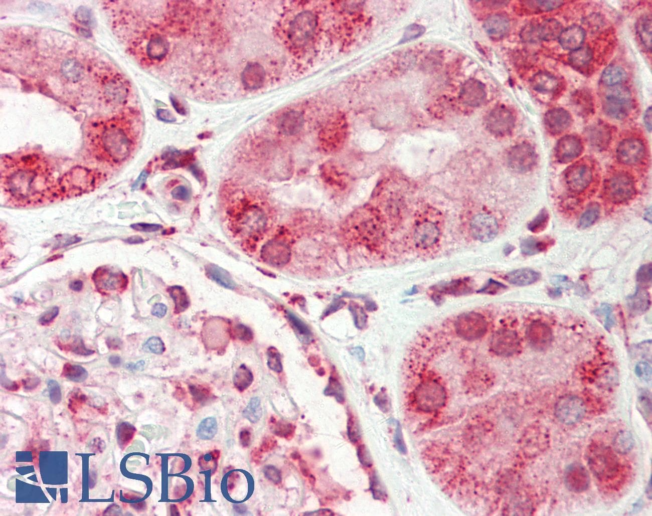 IHC-plus™ Polyclonal Rabbit anti-Human MMP28 Antibody (aa195-223, IHC, WB)