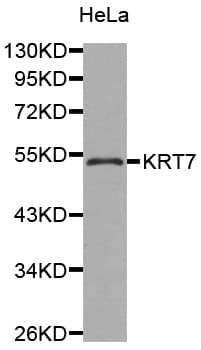 KRT7 / CK7 / Cytokeratin 7 Antibody
