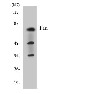 MAPT / Tau Antibody (aa661-710)