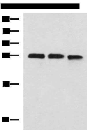 Polyclonal Rabbit anti-Human PLEKHF2 Antibody (IHC, WB)