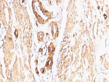 Monoclonal Mouse anti-Human ACTA2 / Smooth Muscle Actin Antibody (clone SPM332, IHC, IF)