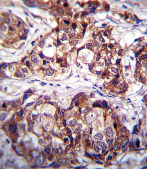 NEP / DDR1 Antibody (aa299-330)