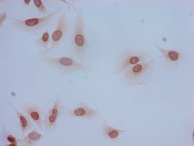 HIST1H2BB Antibody