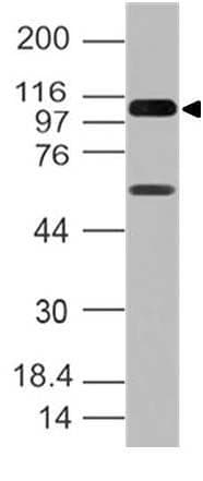 IHC-plus™ Monoclonal Mouse anti-Human DDX58 / RIG-1 / RIG-I Antibody (clone ABM4H29, aa1-220, IHC, WB)