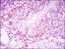 NR3C1/Glucocorticoid Receptor Antibody (clone 6E6)