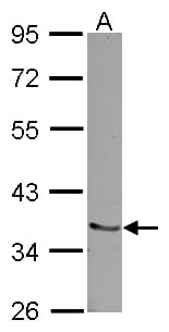 IHC-plus™ RCHY1 / PIRH2 Antibody