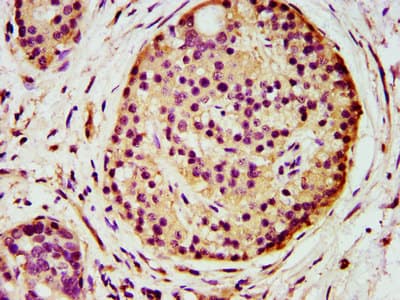 Polyclonal Rabbit anti-Human AGPS Antibody (IHC, IF, WB)