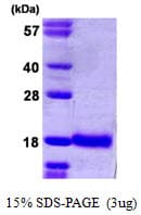 Human UBE2D1 / UBCH5 Protein (Recombinant His)
