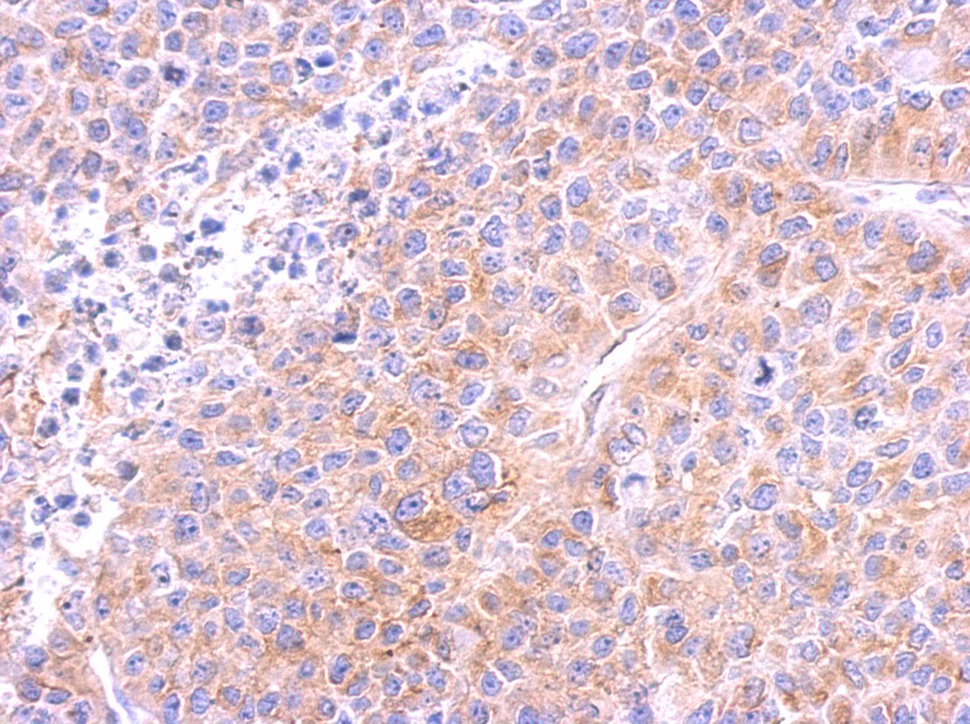 TUBB / Beta Tubulin Antibody