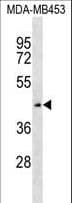 ZNF701 Antibody (aa100-129)