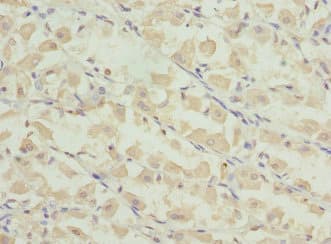 Polyclonal Rabbit anti-Human PRICKLE2 Antibody (IHC)