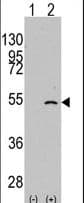 ELP3 Antibody (aa468-498)