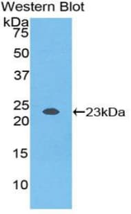 NME3 Antibody (aa2-169, Biotin)