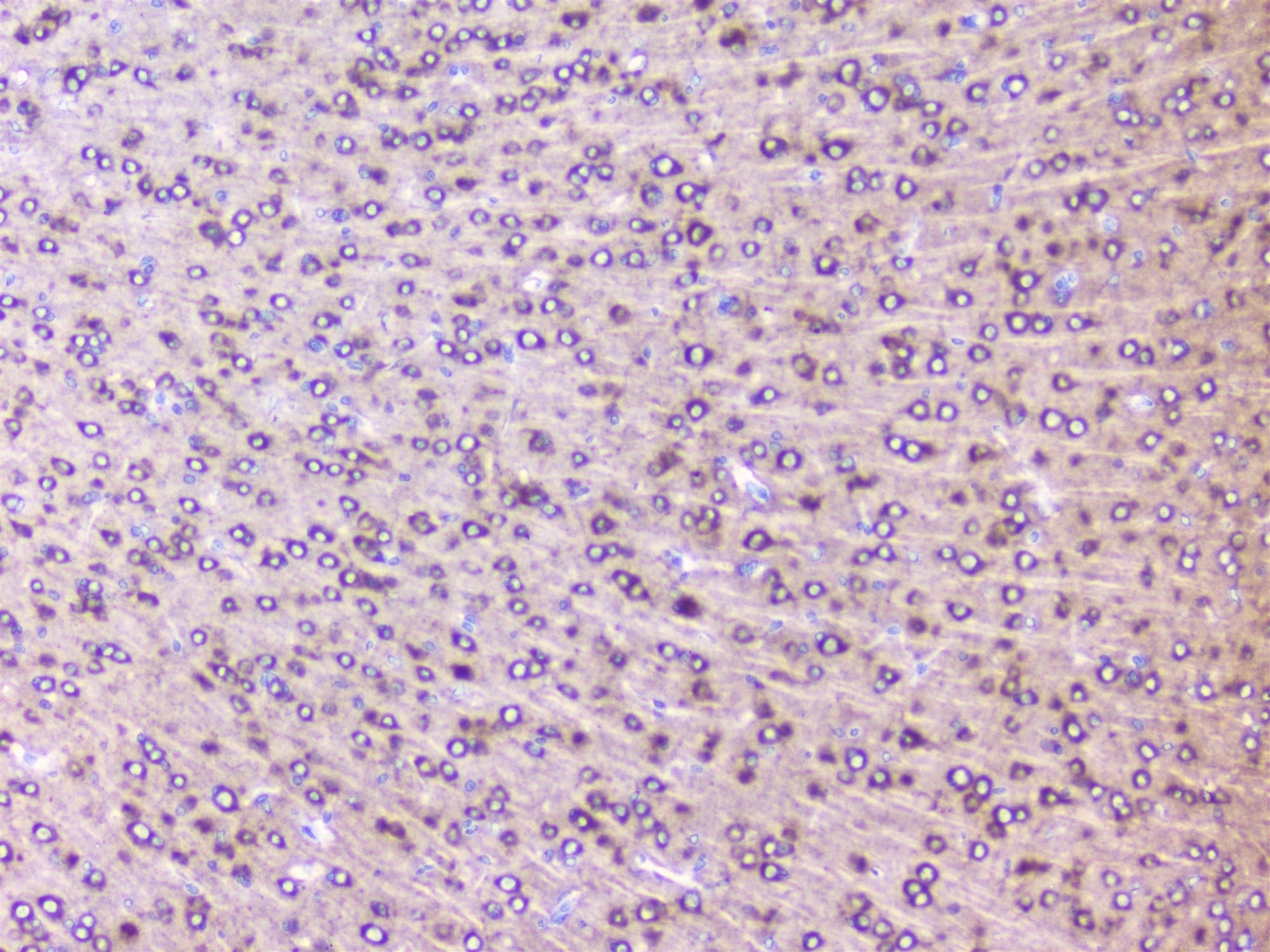 Polyclonal Rabbit anti-Human RPS3 / Ribosomal Protein S3 Antibody (IHC, WB)