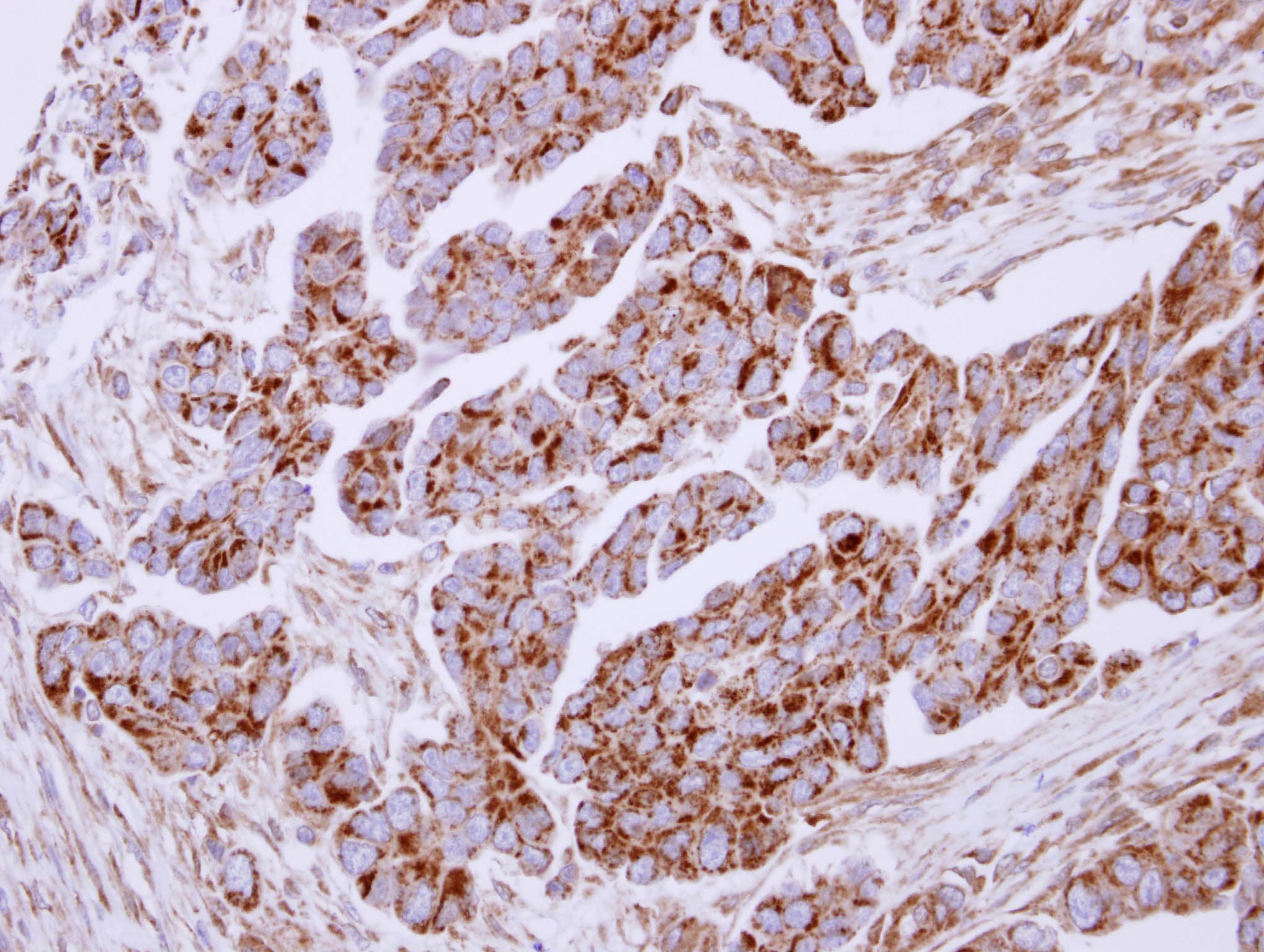 LF / LTF / Lactoferrin Antibody