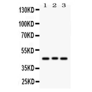 ATXN3 / JOS Antibody (aa226-254)