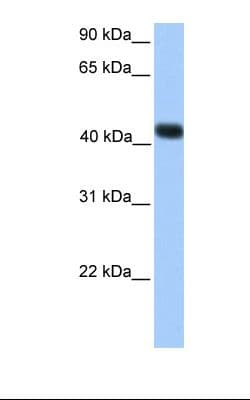 Polyclonal Rabbit anti-Human SSBP4 Antibody (C-Terminus, WB)