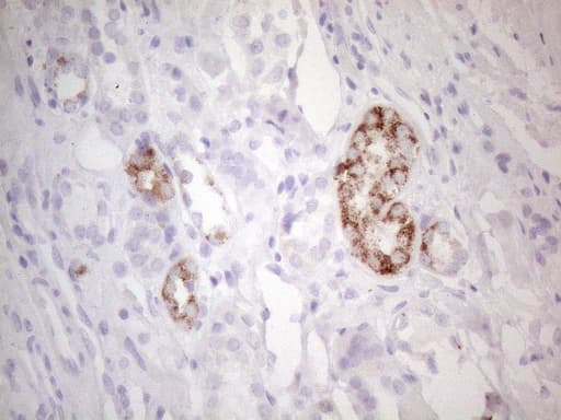 AMACR / P504S Antibody (clone OTI2E3)