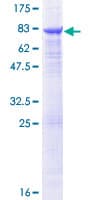 Human TUBB6 / Tubulin Beta 6 Protein (Recombinant GST)