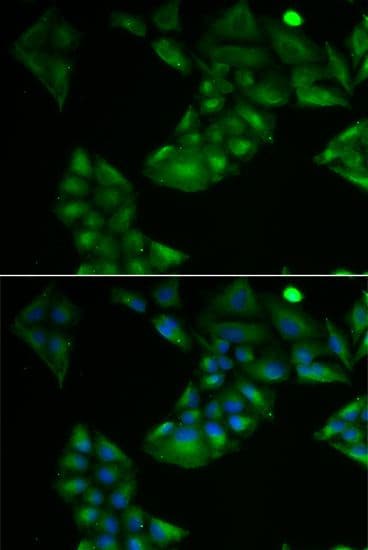 TXN2 / Thioredoxin 2 Antibody