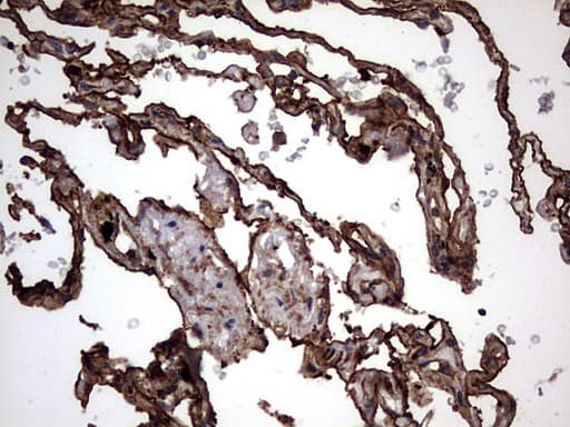 KRT7 / CK7 / Cytokeratin 7 Antibody (clone OTI2A2)