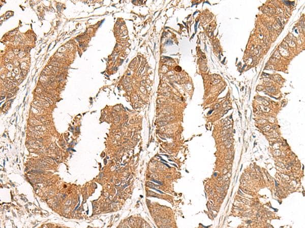 Polyclonal Rabbit anti-Human GCC2 Antibody (IHC)