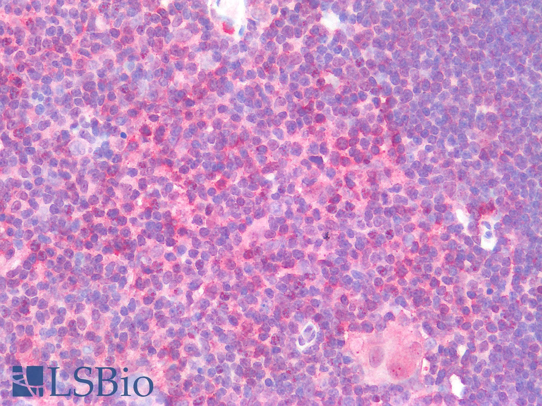 IHC-plus™ CD8A / CD8 Alpha Antibody (clone OTI3H6)